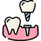 Dental Implant San Antonio